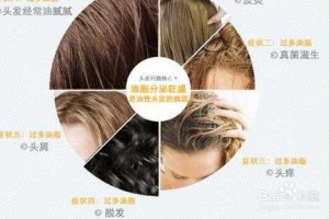 头皮屑多掉发是什么原因（为什么头屑越梳越多）
