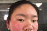 为什么和男朋友在一起脸会特别烫,脸烫代表什么寓意