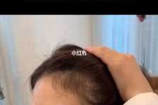 额头高怎么办（额头太高怎么办）