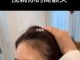 额头高怎么办（额头太高怎么办）