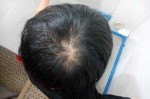 托头发怎么办（托头发是咋回事啊）