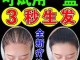 用什么不掉头发（用什么不掉头发还生发）