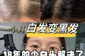如何去白头发,怎么治头发白的好办法