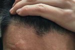 为什么秋天的头发比夏天更油,为什么到秋天头屑多年没好