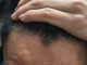为什么秋天的头发比夏天更油,为什么到秋天头屑多年没好