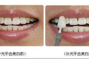 怎么自己美白（怎么自己美白牙齿）