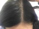 头发生长快是什么原因（男生的头发为什么比女生的头发长得快）