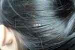 什么人种天生头发白,头发长白白的是什么东西