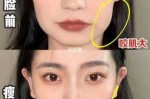 胖脸怎么变瘦脸（脸上肉多如何瘦脸）