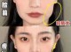 胖脸怎么变瘦脸（脸上肉多如何瘦脸）