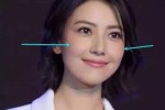 颧骨怎么样好看（有颧骨好看还是没颧骨好看）