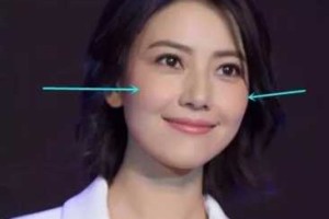 颧骨怎么样好看（有颧骨好看还是没颧骨好看）