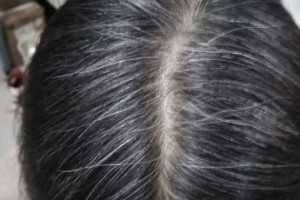 长白头发是什么原因造成的,长白头发是怎么回事?
