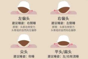 头扁除了剪头还有什么方法,头型扁怎么办怎么补救