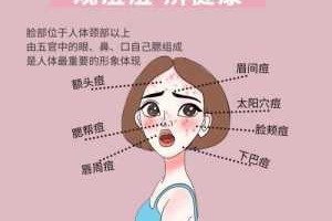 脸上突然长痘痘怎么办,怎么治脸上痘痘最有效