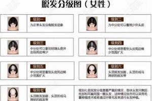 怎么判断脱发类型（怎么判断脱发类型女性）