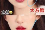 脸大怎么瘦,大脸怎么瘦成小脸