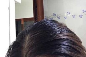 头发睡一晚都油怎么办（头发睡一晚就油是枕头问题吗）