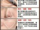脸毛孔堵塞怎么清洁（毛孔有油脂粒怎么疏通）
