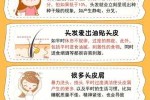 怎么护理头发（头发护理保养方法）