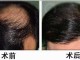 种头发是什么意思（你知道头发的截面是什么形状）