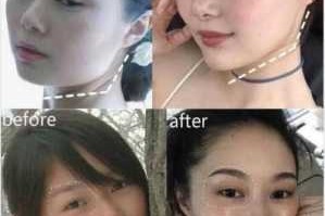 女生脸大怎么办（脸大的女生要怎样改变）