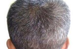 头发长白头发是什么原因（左边头发长白头发是什么原因）