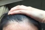 额头长了很多小疙瘩怎么办,额头长怎么办发型