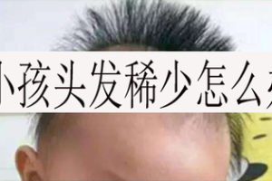 我小孩今年1岁半了，怎么头发特别稀少，特别是头顶上面，怎么办,少年头发稀少怎么办呢