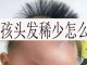 我小孩今年1岁半了，怎么头发特别稀少，特别是头顶上面，怎么办,少年头发稀少怎么办呢