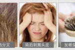头发脏了头皮为什么疼（烫发染发后头皮头顶疼涨并有压迫感是怎么回事）