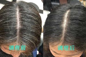 白头发怎么变黑的妙招（白头发怎么变黑的妙招女生）