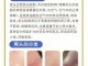 去黑头收缩毛孔最好的方法,怎么收缩黑头毛孔
