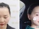 美人尖怎么（怎么把美人尖去掉）