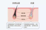 如何黑发,怎么让头发黑色素增多