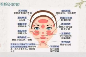 脸上起痤疮怎么治疗（脸上起痤疮怎么治疗最有效）