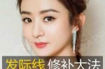发际线是什么位置图片（女生发际线标准）