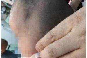 一岁宝宝的头型正常是什么样的,扁头什么样子