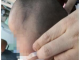 一岁宝宝的头型正常是什么样的,扁头什么样子