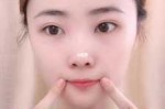 嘴角纹怎么消除,怎么消除嘴角纹路