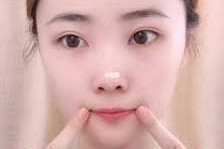 嘴角纹怎么消除,怎么消除嘴角纹路