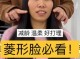 脸颊高怎么办（脸颊颧骨高怎么办）