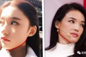 下巴尖脸颊宽是什么脸型,脸宽下巴尖是什么脸型图片