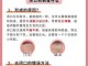 皮肤粉刺如何去除,粉刺怎么去除小妙招
