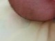 幼儿头发稀少怎么办（宝宝头发细软稀少怎么变粗）