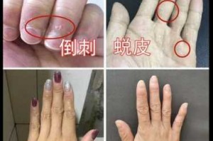 冬天手干燥粗糙还脏洗不干净,冬季手干燥粗糙怎么护理