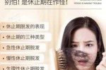 换季掉头发厉害怎么办（换季掉头发厉害怎么办女性）
