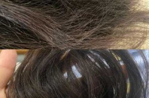 头发掉的厉害，用发膜可以解决吗,秋天掉发严重怎么办扎头发有点痛