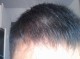 我是男生，我去年2014冬天头发开始变干，以前头发洗好头发都是很有感觉的，很软很坚韧，睡觉的时候会,2014什么发型好看男生