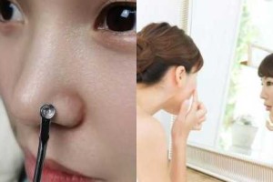 白头粉刺怎么彻底去除（白头粉刺怎么彻底去除视频）